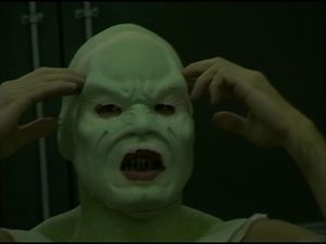 Dan Payne Prothese.jpg